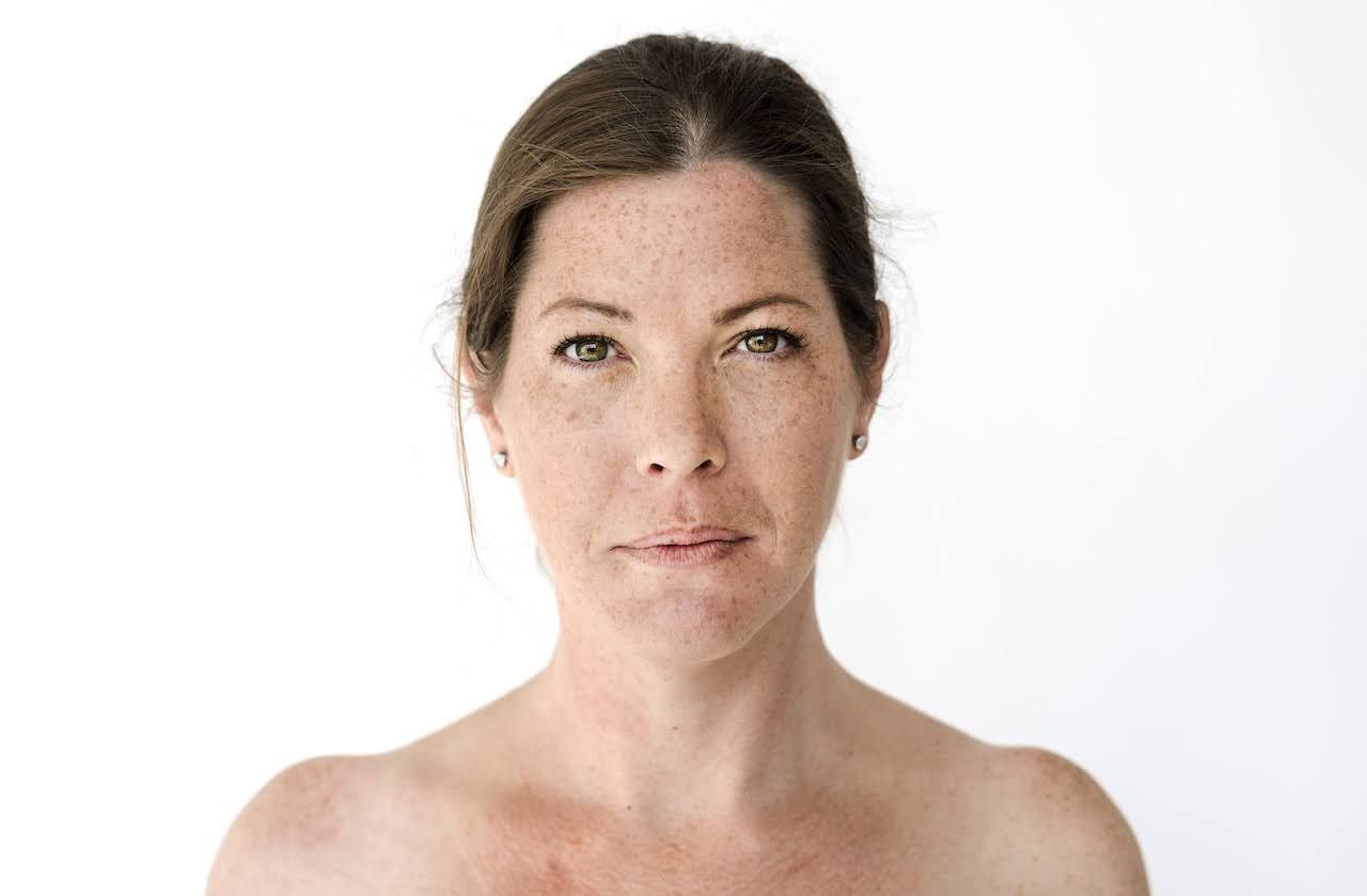 infographic for CAUSES AND TREATMENTS FOR CHRONIC DRY SKIN