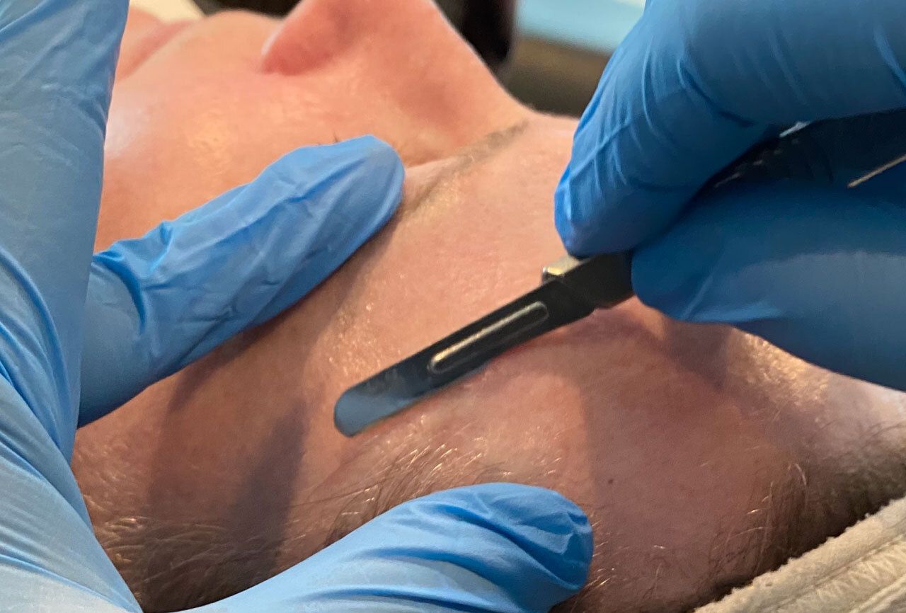 DermaplaningBlog 2 0325