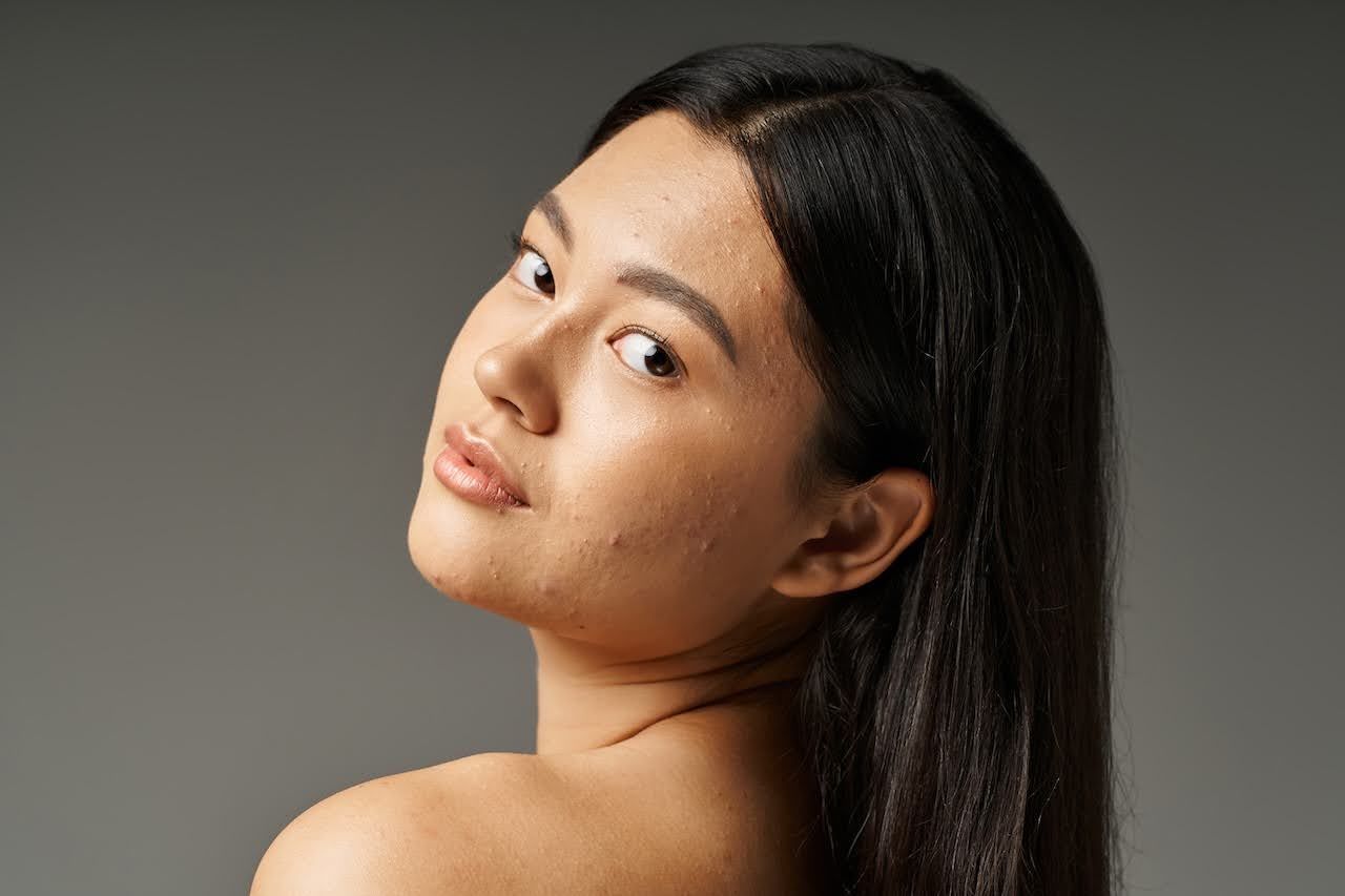 infographic for HOW TO ADDRESS HORMONAL BREAKOUTS DURING THE MENSTRUAL CYCLE