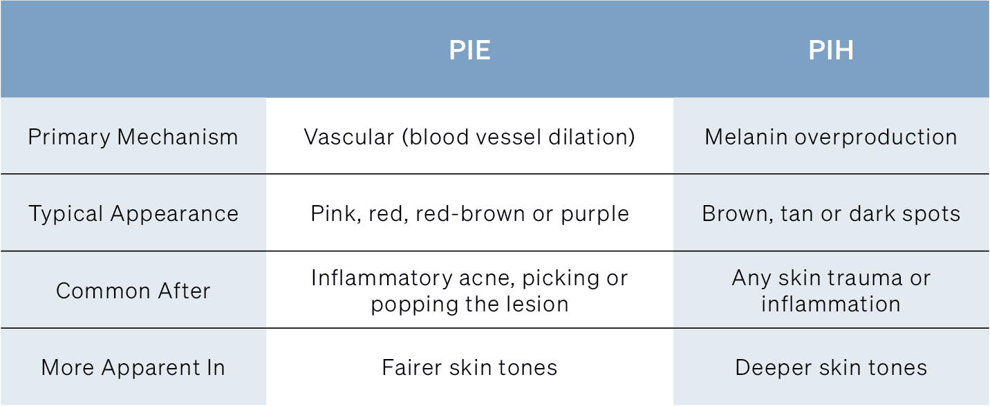 Table comparing PIE and PIH skin conditions: mechanism, appearance, causes, and skin tone impact.