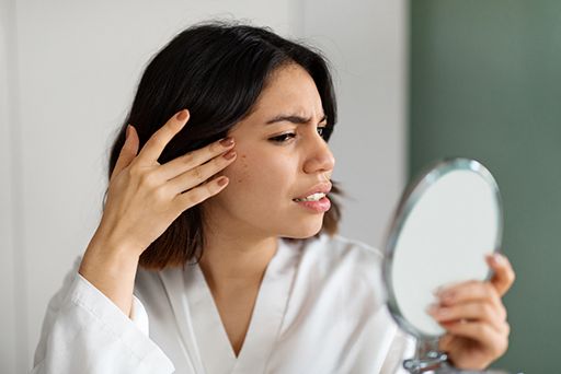 infographic for TEEN VS ADULT ACNE