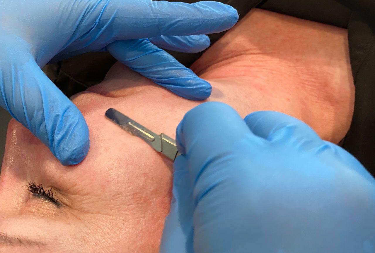 infographic for WHEN AND WHY YOU SHOULD INCORPORATE DERMAPLANING