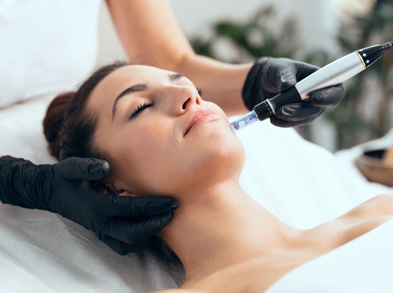 Woman receiving microneedling treatment