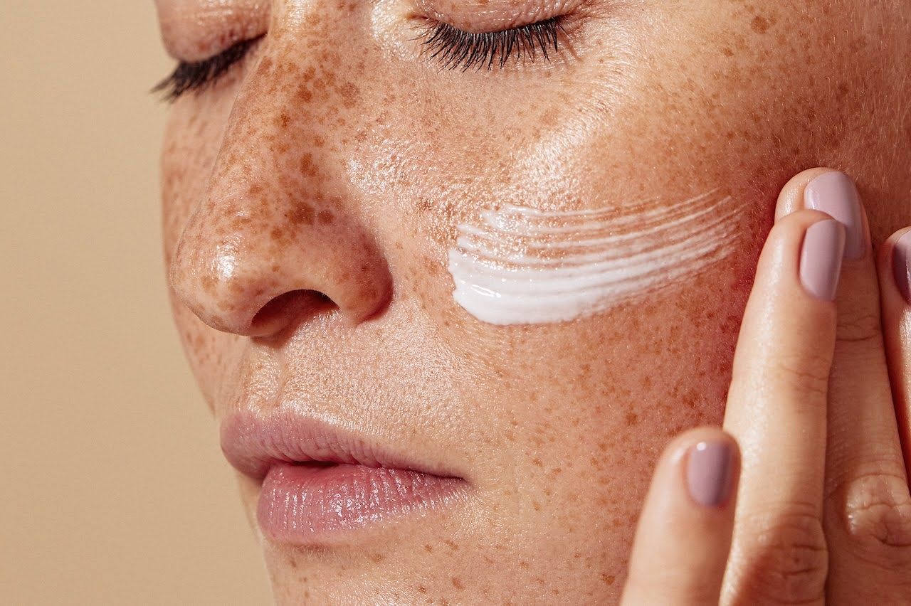 Young woman applying skincare for hyperpigmentation