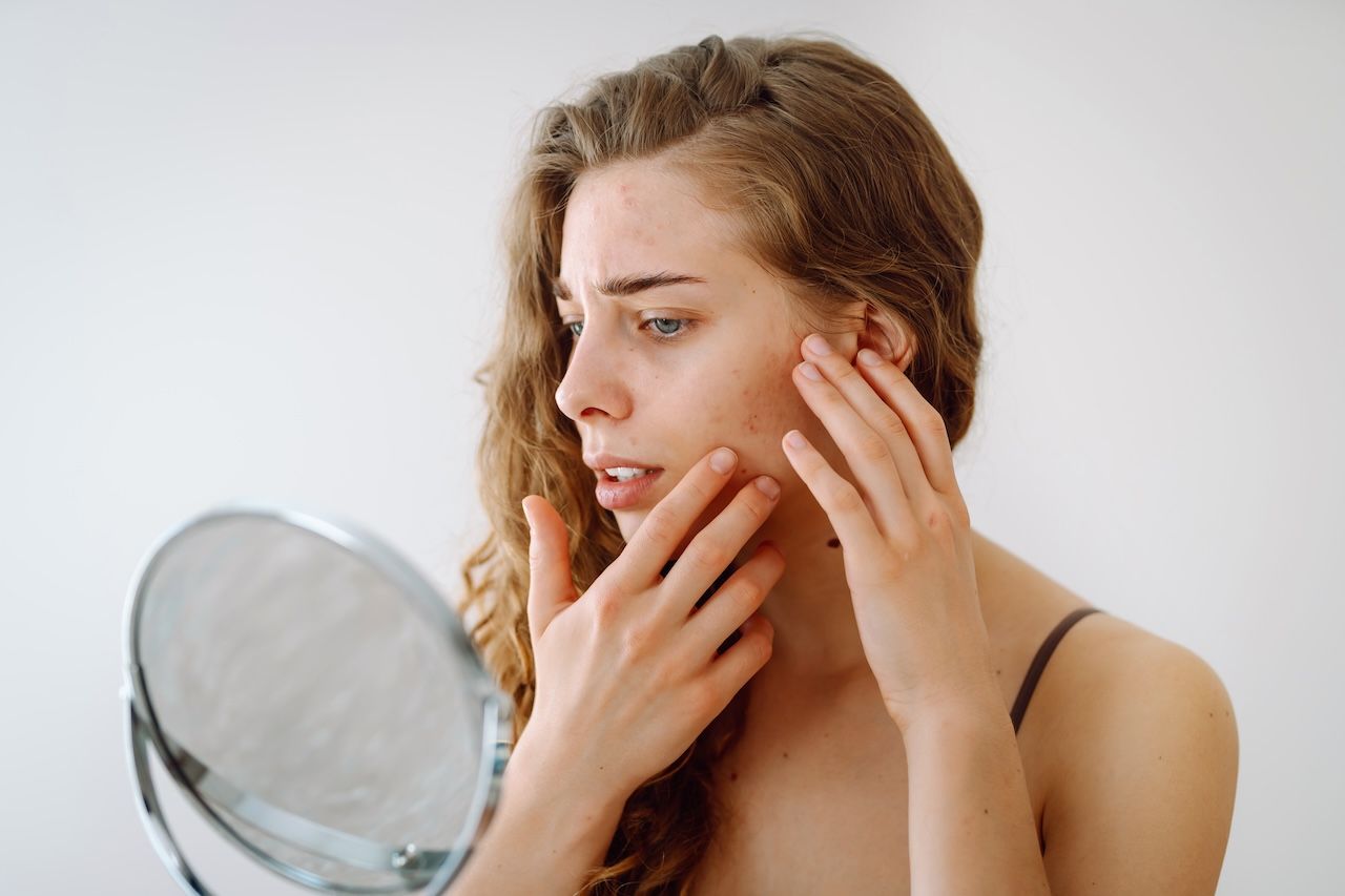 young woman looking at acne on cheek in the mirror