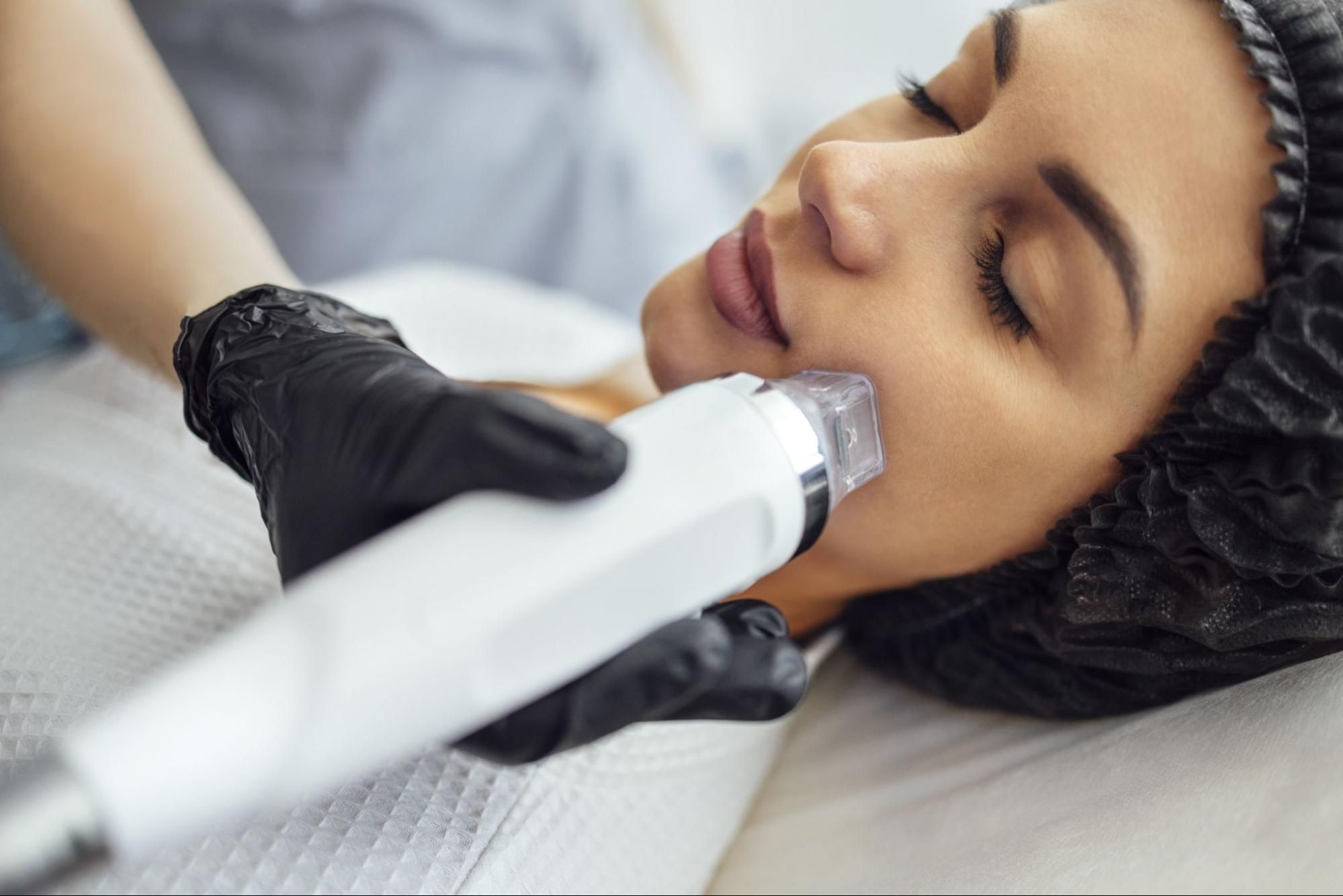 infographic for WHAT HAPPENS TO SKIN DURING RF MICRONEEDLING?